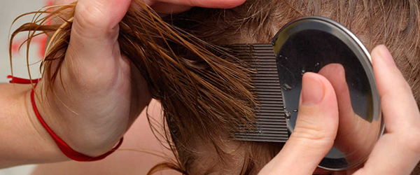 педикульоз 2